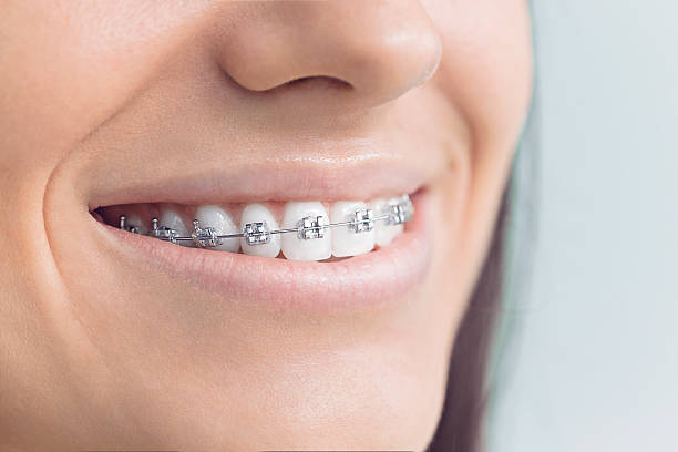 Why Choose Us for Your Dental Needs in Coconut Creek, FL